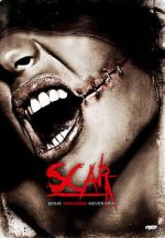 Scar