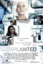 Implanted