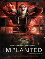 Implanted