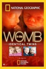 National Geographic: In the Womb - Identical Twins