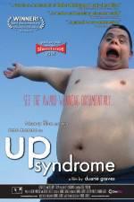 Up Syndrome