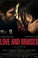 Love and Bruises